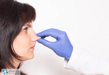 How can a nose job help the allergies?