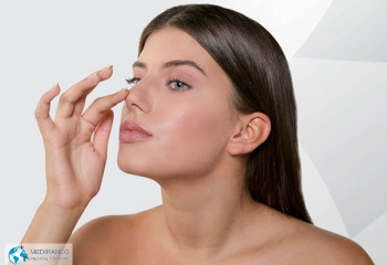 Nose job consultation