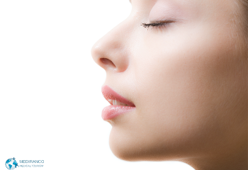 How did your life change after rhinoplasty?