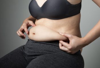 Is liposuction permanent?