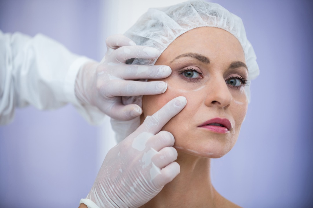 Face Liposuction : All about Buccal Fat, Chin and Cheek | mediranco