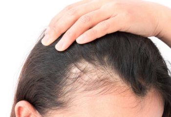 How to stop hair loss after weight loss