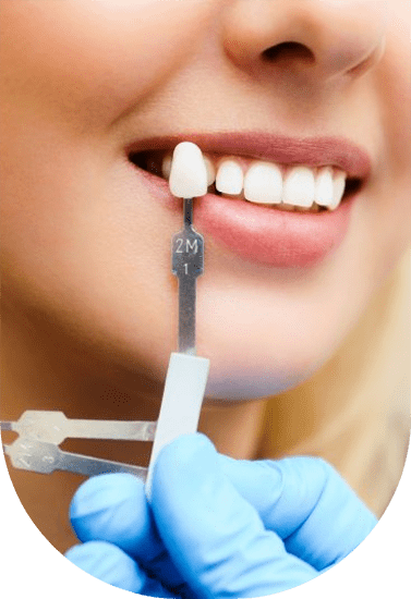 Dental Implant in Iran