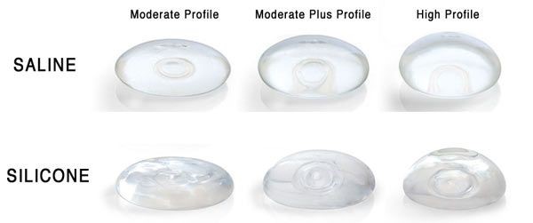 Saline breast implants