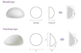 What is Round breast implants?