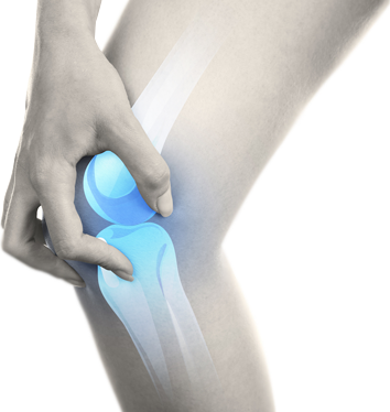 knee arthroplasty