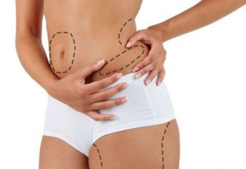 liposuction death rate