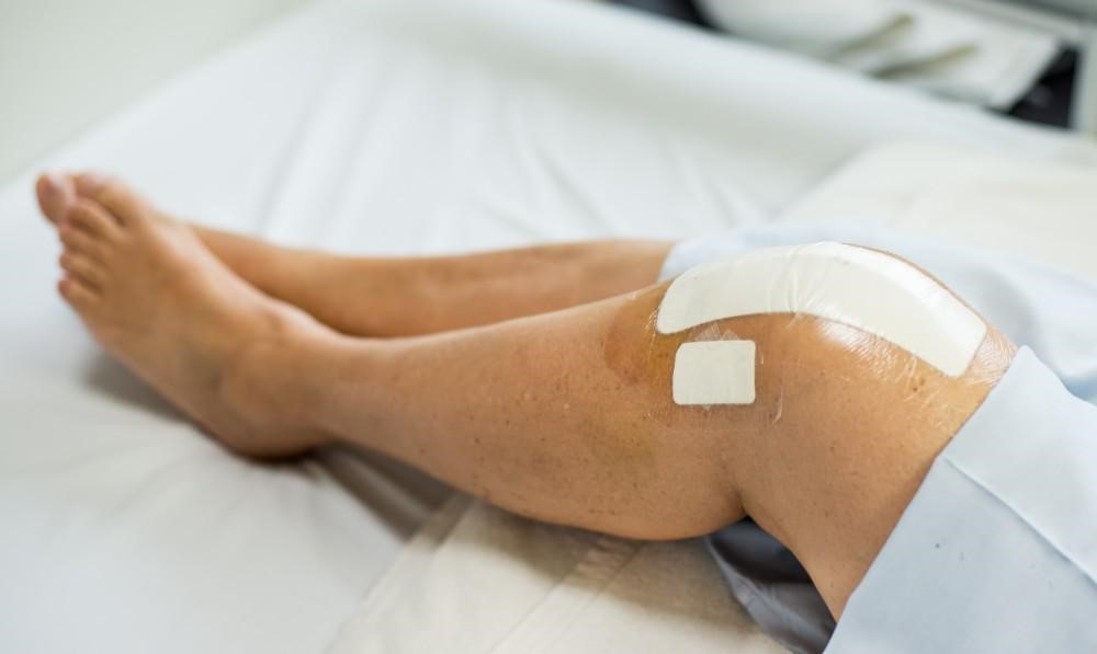 knee replacement recovery