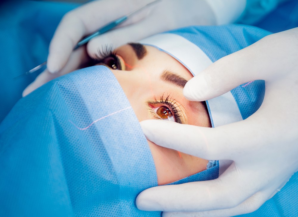 all about LASIK