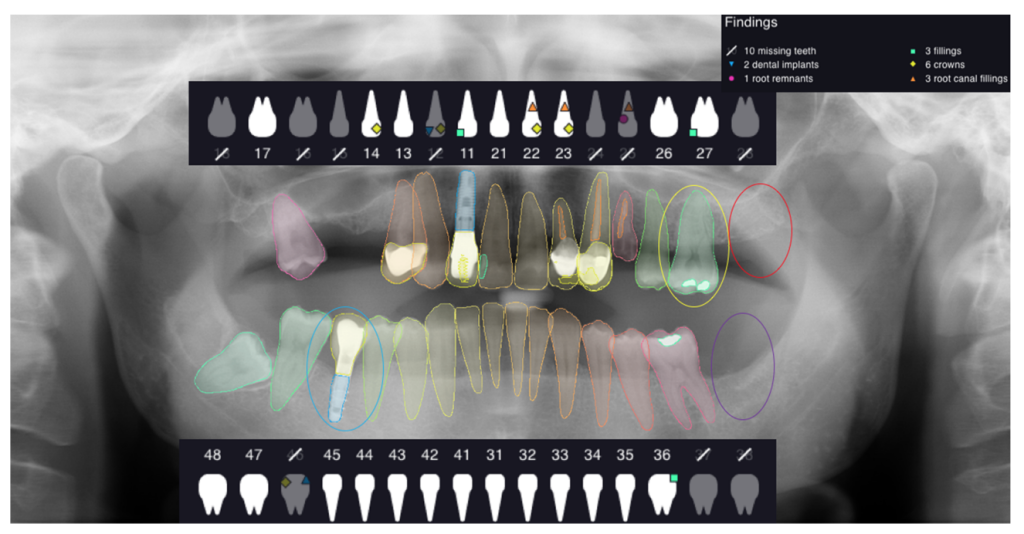 AI in dentistry