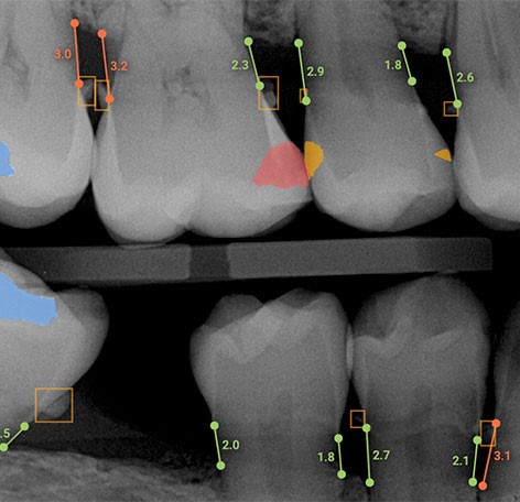 AI in dentistry