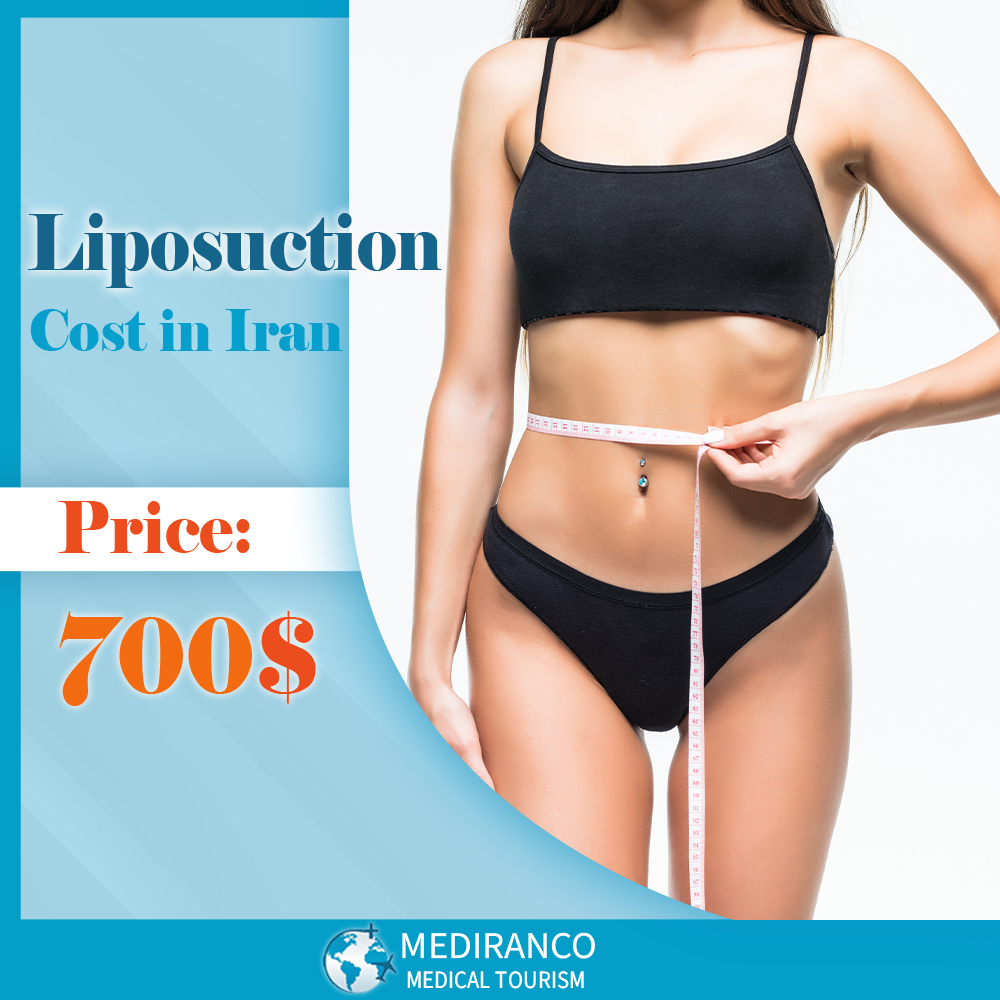  cost of liposuction in Iran
