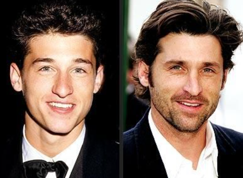 Male celebrity nose job - Patrick Dempsey