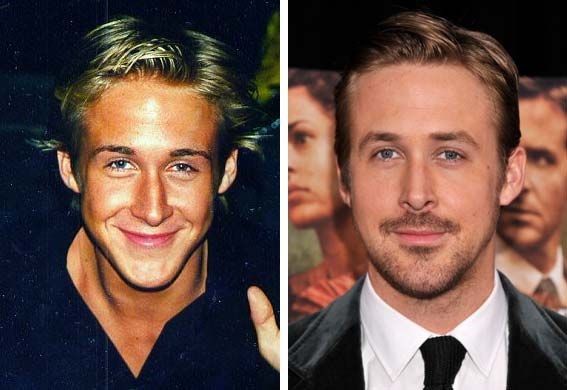 Male celebrity nose job - Ryan Gosling