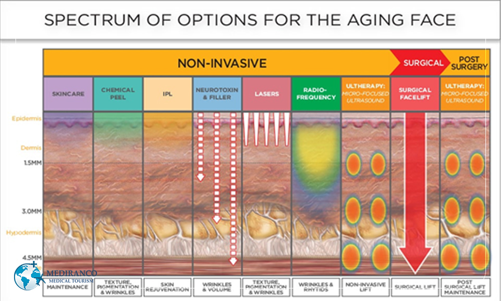 Non surgical facelift