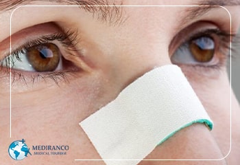 Nose Taping After Rhinoplasty