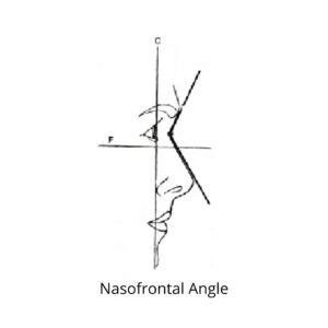 Nasofrontal (Radix Angle)