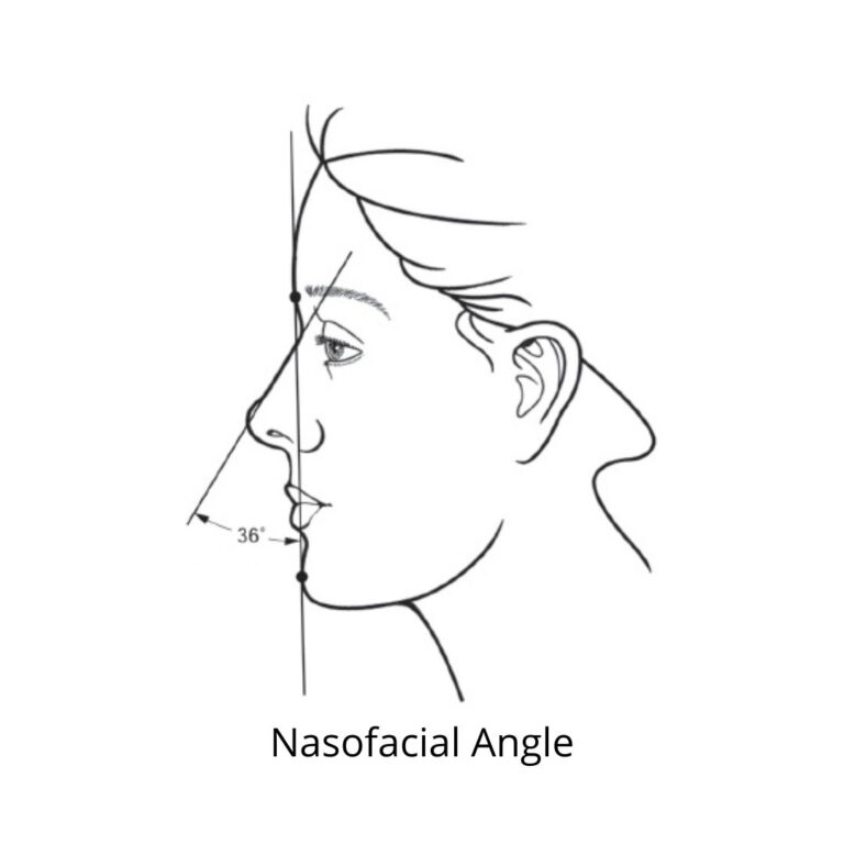 Nasofacial (Frontal Facial Angle)