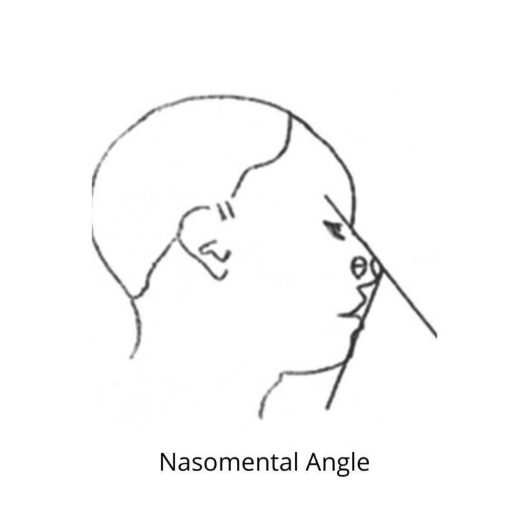 Nasomental (Mental Angle)
