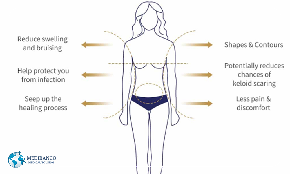Compression Garments after surgery