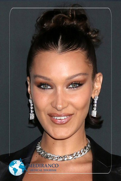 Bella Hadid Before and After
