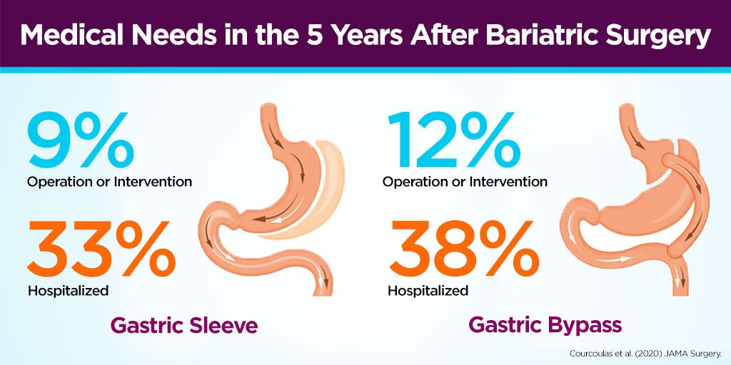 gastric sleeve vs gastric bypass