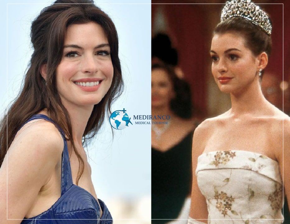 Anne Hathaway