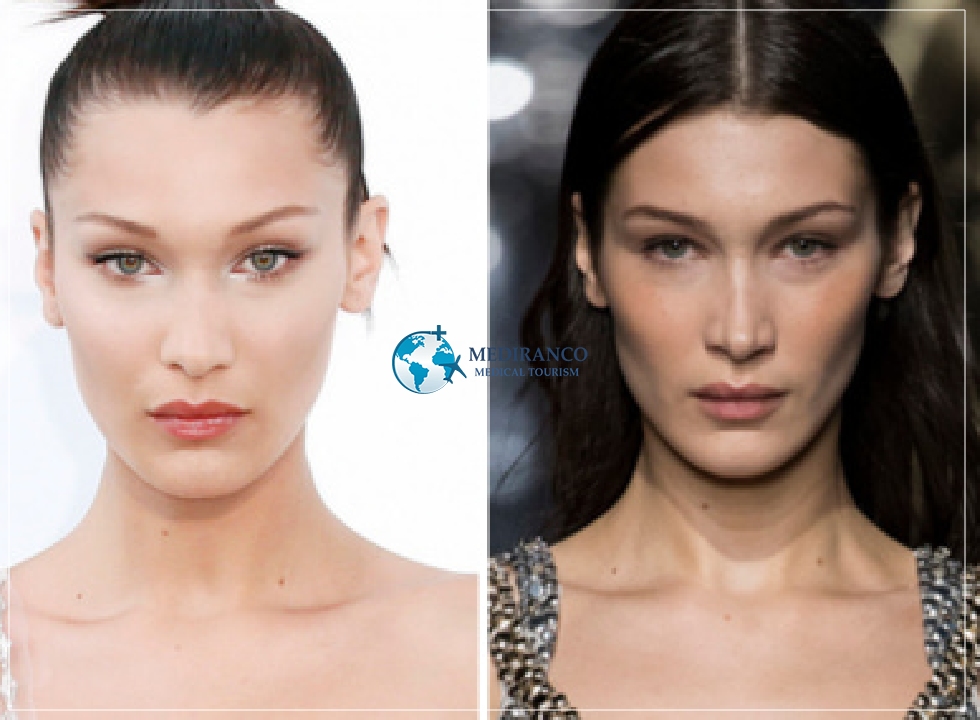 bella hadid face